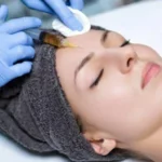 MUJER SOMETIENDOSE A MESOTERAPIA y skinbooster